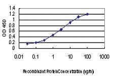 Anti-PRKCD Mouse Monoclonal Antibody [clone: 6A2]