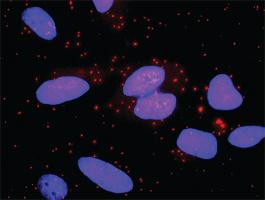 Anti-BID + FAS Antibody Pair