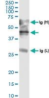 Anti-ADAMTS4 Rabbit Polyclonal Antibody