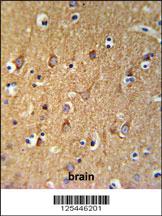 Anti-SGMS2 Rabbit Polyclonal Antibody