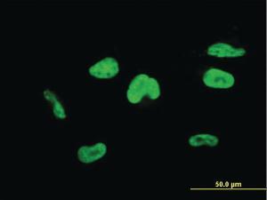 Anti-TCEA3 Mouse Monoclonal Antibody [clone: 4E11]