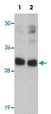 Anti-CCDC106 Rabbit Polyclonal Antibody