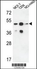 Anti-SGMS2 Rabbit Polyclonal Antibody