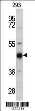 Anti-KRT13 Rabbit Polyclonal Antibody