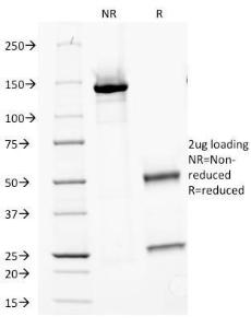 SDS-PAGE analysis of Anti-Major Vault Protein Antibody [1014] under non-reduced and reduced conditions; showing intact IgG and intact heavy and light chains, respectively. SDS-PAGE analysis confirms the integrity and purity of the antibody.