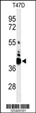 Anti-VTCN1 Rabbit Polyclonal Antibody