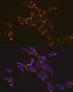 Anti-RNF126 antibody