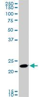 Anti-RAB11A Mouse Monoclonal Antibody [clone: 1F7-2A8]