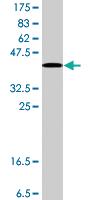 Anti-QPCT Mouse Polyclonal Antibody