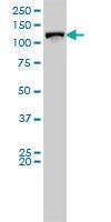 Anti-VCL Mouse Monoclonal Antibody [clone: 10B2533]