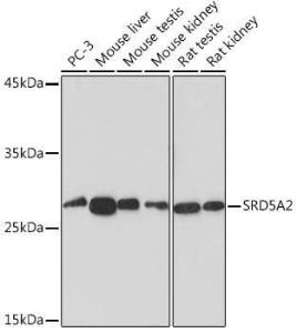 Western blot analysis of extracts of various cell lines, using Anti-SRD5A2 Antibody [ARC2287] (A307681) at 1:1,000 dilution. The secondary antibody was Goat Anti-Rabbit IgG H&L Antibody (HRP) at 1:10,000 dilution.