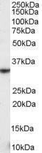 Anti-KLRK1 Antibody (A84110) staining (03 µg/ml) of Human Spleen lysate (RIPA buffer, 35 µg total protein per lane) Detected by chemiluminescence