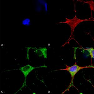 Anti-CLC3 antibody