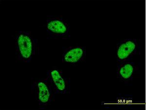 Anti-SF1 Mouse Monoclonal Antibody [clone: 2E12]