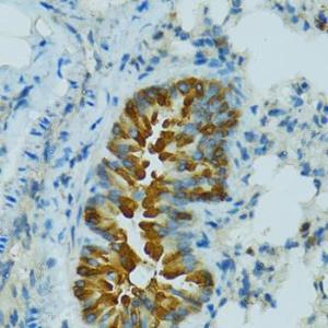 Anti-Cytochrome P450 2B6/CYP2B6 Rabbit Polyclonal Antibody