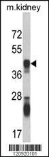 Anti-ASS1 Rabbit Polyclonal Antibody