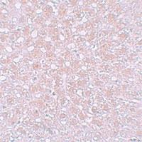 Anti-AFP Rabbit Polyclonal Antibody