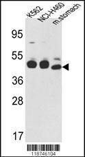 Anti-KRT18 Rabbit Polyclonal Antibody