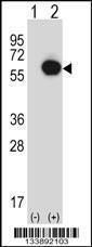 Anti-RANGAP1 Rabbit Polyclonal Antibody (AP (Alkaline Phosphatase))