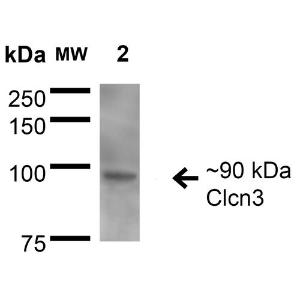 Anti-CLC3 antibody