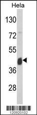 Anti-ASS1 Rabbit Polyclonal Antibody