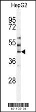 Anti-STK24 Rabbit Polyclonal Antibody