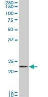 Anti-RAB11A Mouse Monoclonal Antibody [clone: 1F7-2A8]