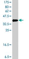 Anti-GTF2IRD1 Mouse Polyclonal Antibody