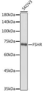 Western blot analysis of extracts of SKOV3 cells, using Anti-FSH-R Antibody (A11453) at 1:1,000 dilution. The secondary antibody was Goat Anti-Rabbit IgG H&L Antibody (HRP) at 1:10,000 dilution.