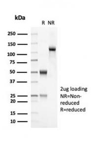 SDS-PAGE analysis of Anti-OLIG2 Antibody [OLIG2/7074R] under non-reduced and reduced conditions; showing intact IgG and intact heavy and light chains, respectively SDS-PAGE analysis confirms the integrity and purity of the antibody