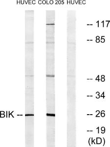 Western blot analysis of lysates from HUVEC/COLO205 using Anti-BIK Antibody. The right hand lane represents a negative control, where the Antibody is blocked by the immunising peptide