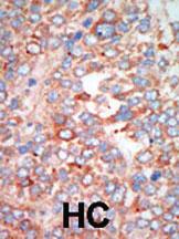 Anti-STK24 Rabbit Polyclonal Antibody