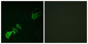 Immunofluorescence analysis of A549 cells using Anti-Abl (phospho Tyr393 + Tyr412) Antibody. The right hand panel represents a negative control, where the antibody was pre-incubated with the immunising peptide