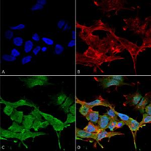 Anti-CLC3 antibody