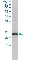 Anti-RAB11A Mouse Monoclonal Antibody [clone: 1F7-2A8]