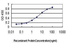 Anti-SF1 Mouse Monoclonal Antibody [clone: 2E12]