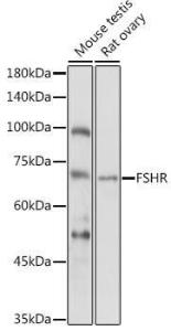 Western blot analysis of extracts of various cell lines, using Anti-FSH-R Antibody (A11453) at 1:1,000 dilution. The secondary antibody was Goat Anti-Rabbit IgG H&L Antibody (HRP) at 1:10,000 dilution.