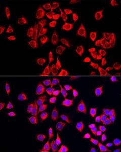 Immunofluorescence analysis of HeLa cells using Anti-COX IV Antibody (A309799) at a dilution of 1:50 (40X lens). DAPI was used to stain the cell nuclei (blue)