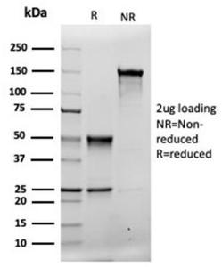 SDS-PAGE analysis of Anti-MSH2 Antibody [rMSH2/6548] under non-reduced and reduced conditions; showing intact IgG and intact heavy and light chains, respectively. SDS-PAGE analysis confirms the integrity and purity of the antibody