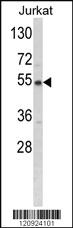 Anti-BCKDHA Rabbit Polyclonal Antibody