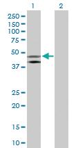 Anti-HOMER1 Rabbit Polyclonal Antibody