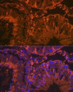 Immunofluorescence analysis of rat testis using Anti-SRD5A2 Antibody [ARC2287] (A307681) at a dilution of 1:100 (40x lens). DAPI was used to stain the cell nuclei (blue).