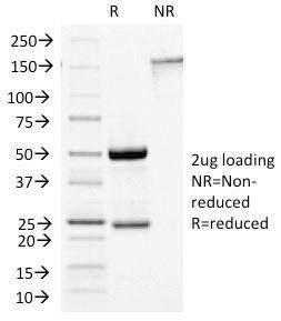 SDS-PAGE analysis of Anti-Growth Hormone Antibody [GH/1450] under non-reduced and reduced conditions; showing intact IgG and intact heavy and light chains, respectively SDS-PAGE analysis confirms the integrity and purity of the antibody