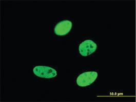 Anti-FOXA2 Mouse Monoclonal Antibody [clone: 4C2]