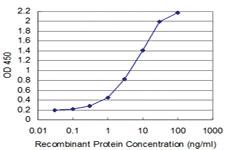 Anti-TCEA3 Mouse Monoclonal Antibody [clone: 4E11]