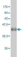 Anti-FGFR2 Mouse Monoclonal Antibody [clone: 2C11]