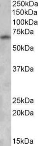 Anti-GAD1 Antibody (A82616) (0.5 µg/ml) staining of Human Brain (Cerebral Cortex) lysate (35 µg protein in RIPA buffer). Detected by chemiluminescence