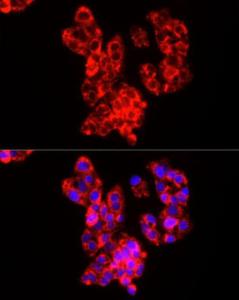 Immunofluorescence analysis of HepG2 cells using Anti-COX IV Antibody (A309799) at a dilution of 1:50 (40X lens). DAPI was used to stain the cell nuclei (blue)