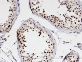 Anti-NCBP1 Mouse Monoclonal Antibody [clone: 1E9]