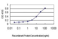 Anti-RAB11A Mouse Monoclonal Antibody [clone: 1F7-2A8]